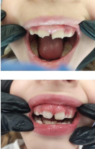 dentista intantil en granada